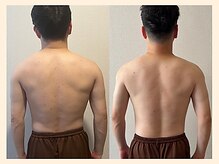 ラフリー 西宮北口院(RUFFREE)/辛い肩こり首こり根本から改善