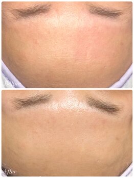 シャナ(Shana)/マリムーブWAX