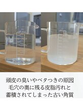 キラリ リラクゼーション(Kirary relaxation)/頭皮洗浄後の皮脂汚れ