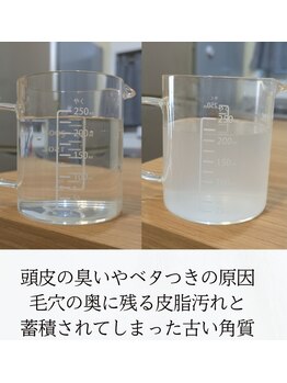 キラリ リラクゼーション(Kirary relaxation)/頭皮洗浄後の皮脂汚れ