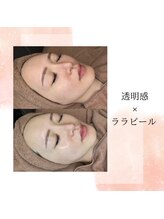 アーニストリィ(Earnestly)/ララピール　　水光肌