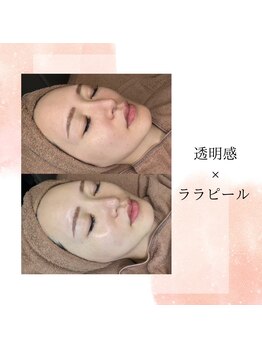 アーニストリィ(Earnestly)/ララピール　　水光肌