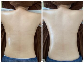 フィール(feel)/Before/After リンパマッサージ