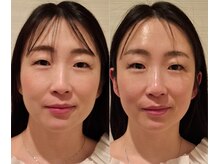 バリューネクスト 青葉台の雰囲気（ついに登場★レモンボトルで脂肪分解！半永久！リバウンドなし！）