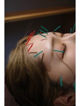 栄光治院 安城院/眼精疲労から卒業！