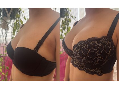 ビービリア(B.villea)の写真