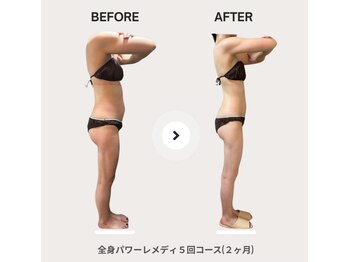 ビループ(biloop)/今年中に変わりたい方はbiloopへ