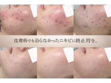 ジジベレッザ 大阪中崎町店(jiji belleza)の雰囲気（看護師の視点で、どこへ行っても変わらなかった肌悩みに答えます）