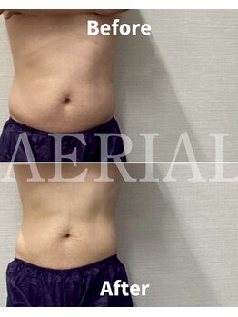 エアリアル 筑紫野店/メンズにも大人気！