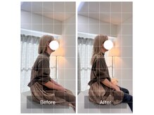 寿 上野院(KOTOBUKI)の雰囲気（【自律神経専門院】肩こり/頭痛/腰痛/骨盤矯正など幅広く対応！）