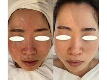 クレールアンジュ(ClairAnge)/お肌の赤みが気になる方