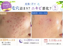 おうちサロン ミキ