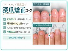 【深爪矯正・自爪育成】専門ネイルサロン ルシェルアイ 西宮店の雰囲気（見た目を即日改善【深爪矯正コース】）