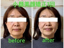 癒し処ゆず/小顔美顔矯正でお若く！！