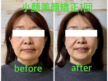 癒し処ゆず/小顔美顔矯正でお若く！！