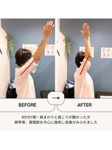 リロット(relot)/肩回りの施術