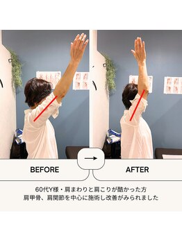 リロット(relot)/肩回りの施術