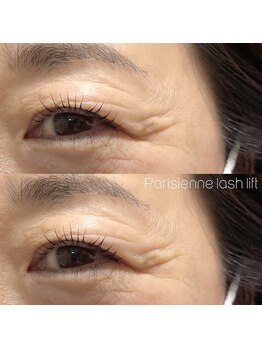 カロン(Kalon)/パリジェンヌラッシュリフト