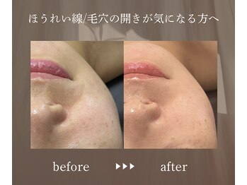 エメ(eme)/放っておかないで！早めに改善を