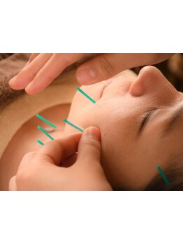 鍼灸施術を受けたい