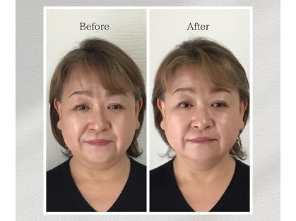 トータルトリートメント優鍼灸院の写真
