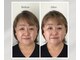 トータルトリートメント優鍼灸院の写真