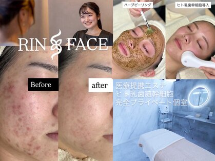 リンフェイス 表参道(RIN FACE)の写真