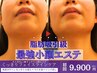 【小顔集中ケア】脂肪分解×浸透美容×引き締めケア★19,800円→9,900円
