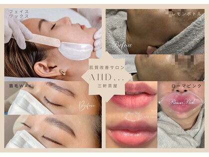 アンド(and...)の写真