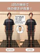 スペックフィジカルコンディショニング(SPECフィジカルコンディショニング)/40代女性/姿勢ビフォーアフター