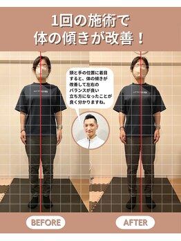 スペックフィジカルコンディショニング(SPECフィジカルコンディショニング)/40代女性/姿勢ビフォーアフター