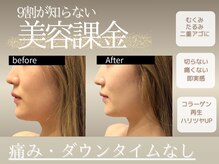 エスポワールカルド(Espoir caldo)