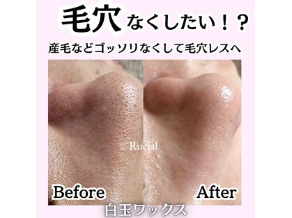 ルシアル(Rucial)の写真