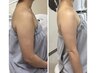夏直前上半身徹底（二の腕・背中・首・デコルテ）　６０分