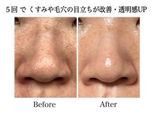 ナチュラーレ 天王寺店(Naturale)/美肌ニキビケア小顔フェイシャル