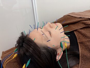 リアン鍼灸院整骨院(Lien鍼灸院整骨院)の写真/美容鍼×整顔・小顔矯正×内臓調整でむくみ、たるみ、ほうれい線などを体の内と外から徹底ケア