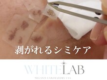 サロン リノ(SALON Lino)の雰囲気（剥がれるシミケア★シミ・カンパン改善◎）