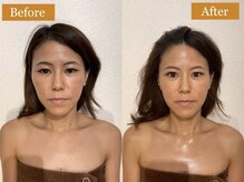 モモスパ(MOMOspa.)/頭蓋骨小顔矯正ビフォアフター