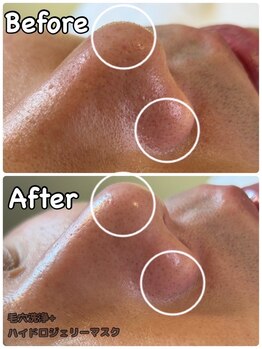 バイカラー(BY COLOR)/【毛穴洗浄】