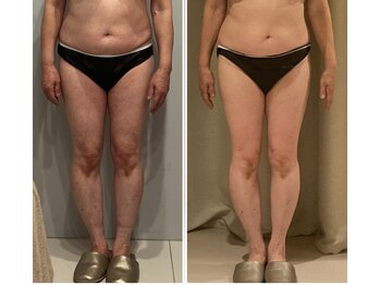 ドゥ ボーテ(de beaute)/de beaute