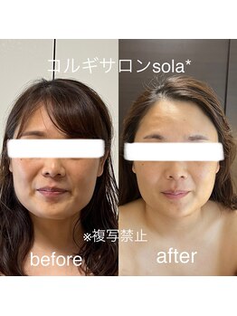 ソラ(sola*)/血流も改善肌色UP