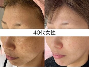 サクラ 本厚木駅前店(SAKURA)/40代後半のお客様 14回目