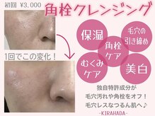 キラ肌 出雲店/角栓クレンジング！
