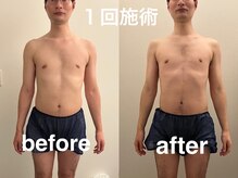 ヴィセラ(Vicella)/正常な位置に戻りました！