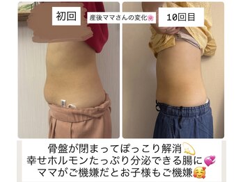 ネネ(Nene)/ビフォーアフター