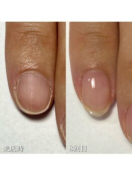 オリ ネイル(Oli_nail)/