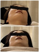 アンフィニ 尼崎店(Anfini)/ヘッドマッサージで歪みも整う