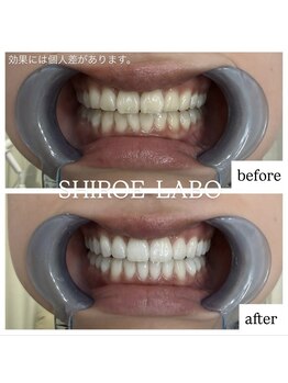 シロエラボ 梅田店/before、after