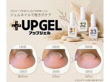 ネイリット 銀座(Nailit)/★大好評★【巻き爪ケア】UP GEL