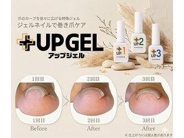 ★大好評★【巻き爪ケア】UP GEL